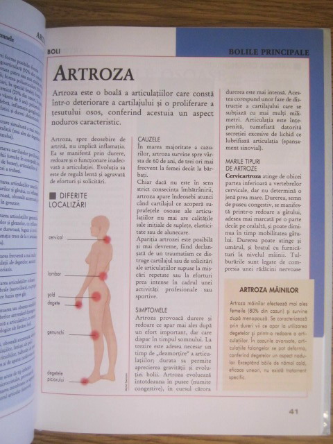 enciclopedie medicală a bolilor articulare