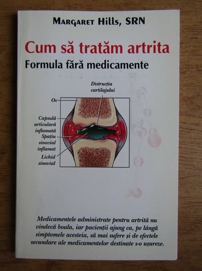 degetul inelar pe articulație doare articulațiile devin dureroase după scurgere